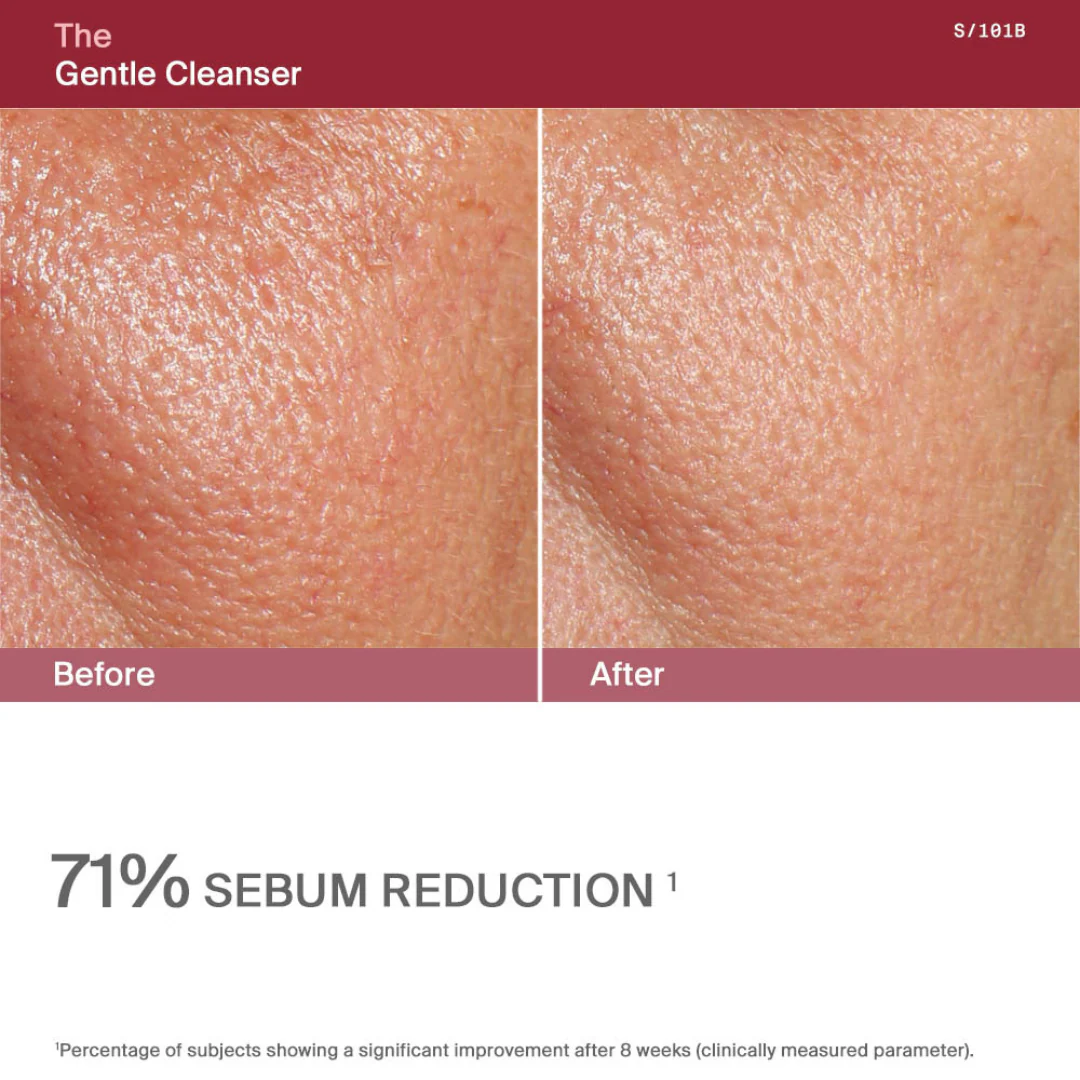 The Gentle Cleanser - Image 4