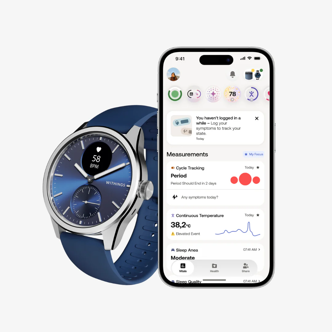 Scanwatch 2 - Blue - Image 5